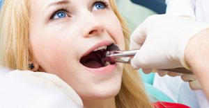 myDentalcare offers wisdom teeth extraction for patients of all ages. We are dedicated to making sure your experience is as pleasant as possible.