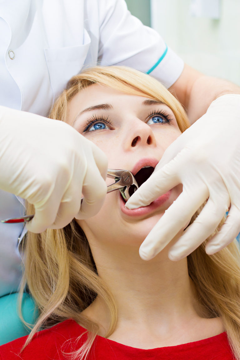 Woman getting wisdom teeth removal proceduremyDentalCare